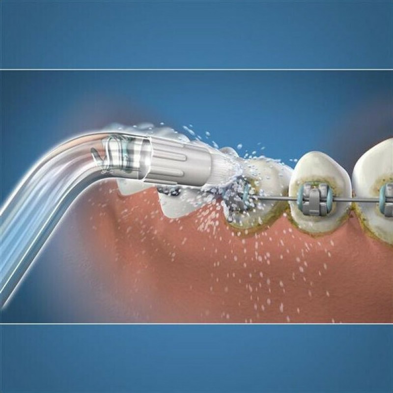 WATERPIK Orthodontic Tip OD-100E Ανταλλακτικά  2τμχ